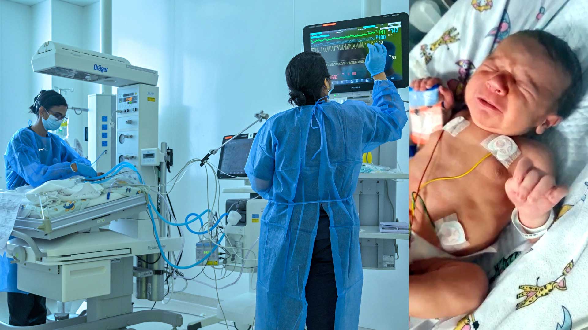 Burjeel Medical City Performs UAE’s Youngest Infant Liver Transplant