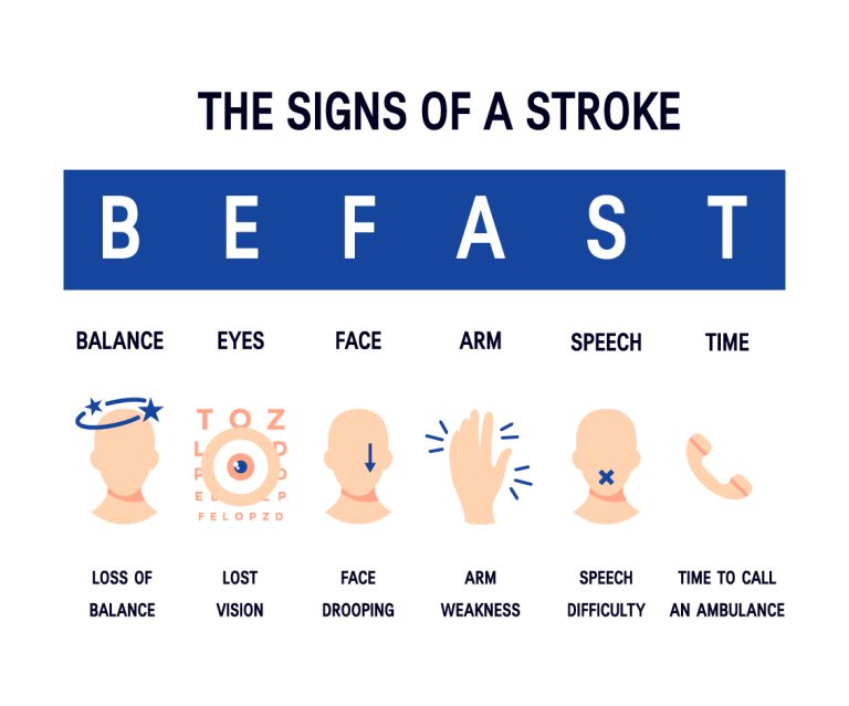 Stroke – Risk Factors & Prevention