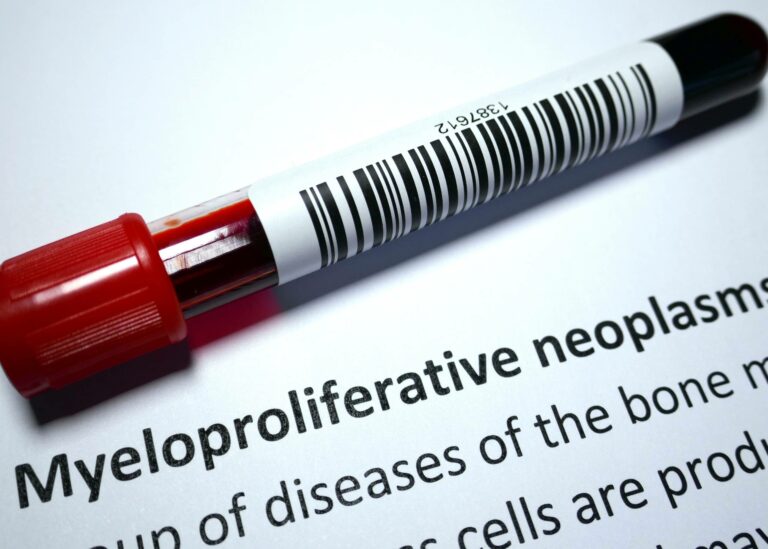 Myeloproliferative Neoplasms (MPN) – Symptoms, Causes & Treatment