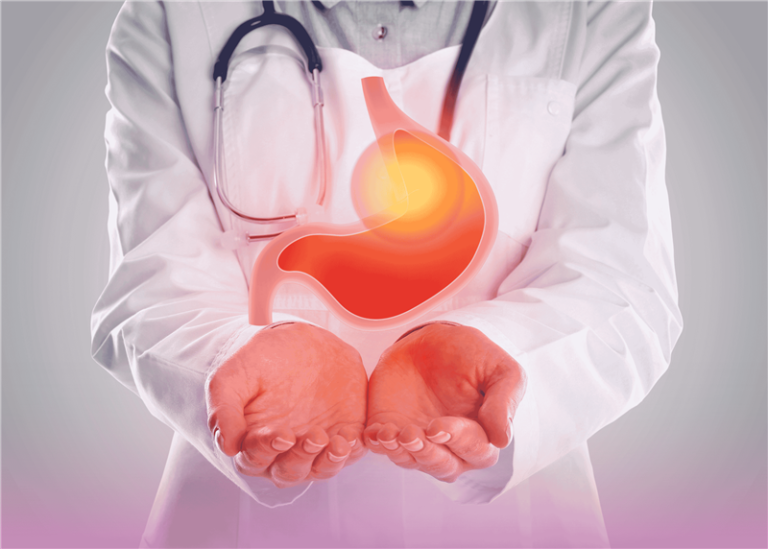 متلازمة الارتجاع المعدي المريئي وتضيق المريء: الأسباب والأعراض والعلاج