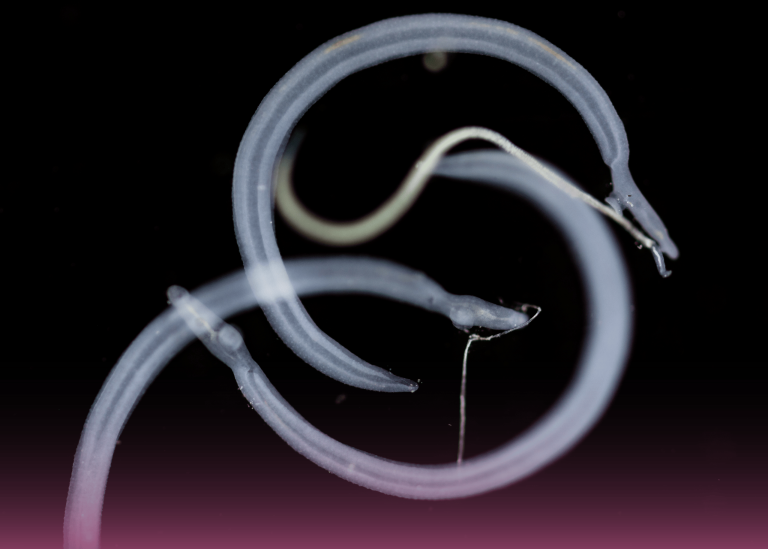 Diagnosing Schistosomiasis in a Patient with Urinary Symptoms: A Clinical Detective Story