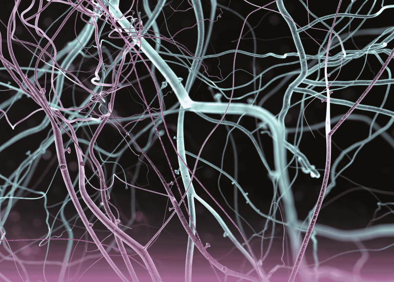 التدبير الجراحي لورم الأرومة العصبية عند الأطفال: دراسة حالة معقدة